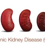 kidney disease