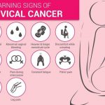 cervical cancer